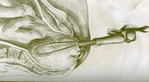 Drawing of a child being delivered with Dr. Smellie's forceps